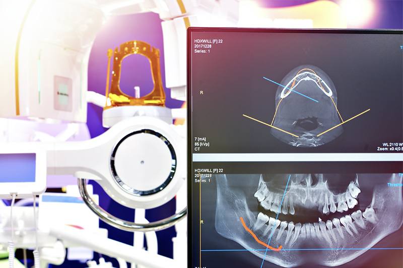 Digital X-rays for children